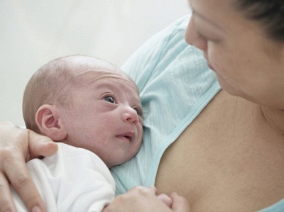 Hội chứng Cri du chat - Hình ảnh minh họa